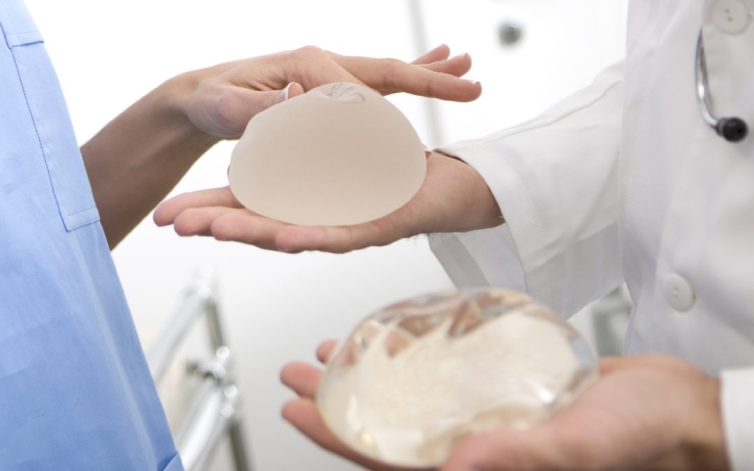 Mamoplastia de Aumento: Como saber quando você precisa trocar a prótese de silicone